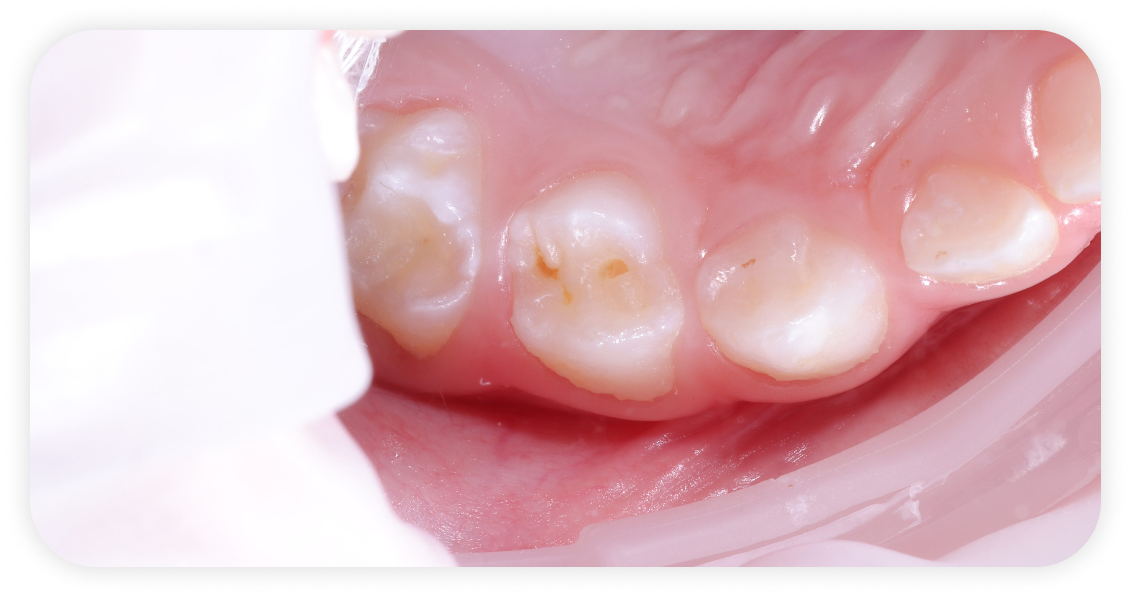Before